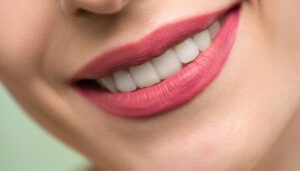 professional teeth whitening in Tonbridge